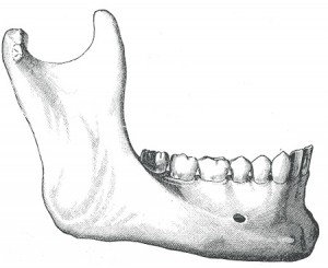 lower jaw