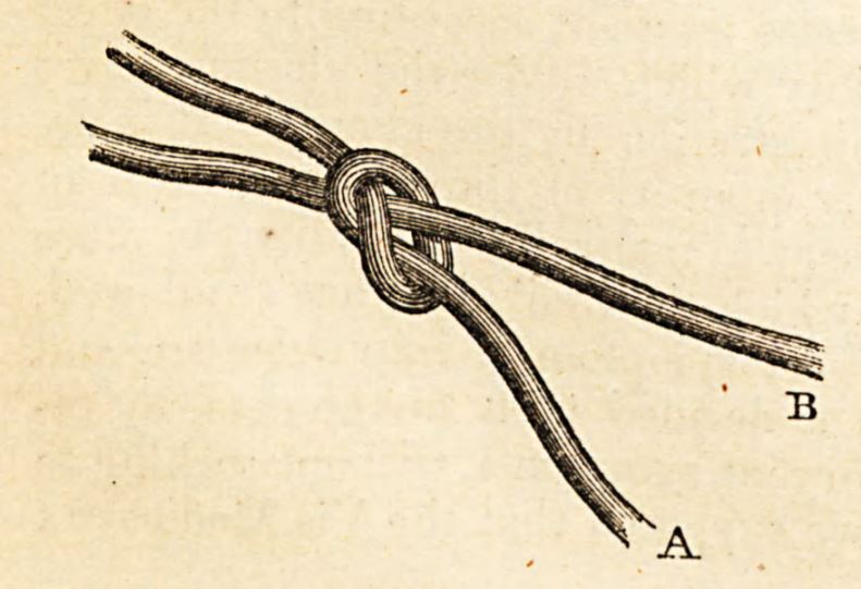 umbilical knot