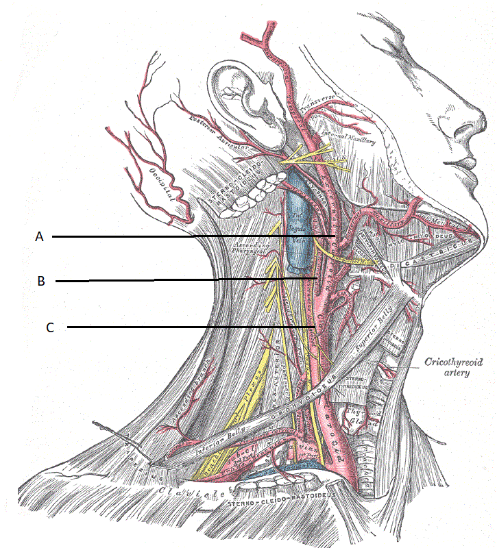 Diagram of carotid artery