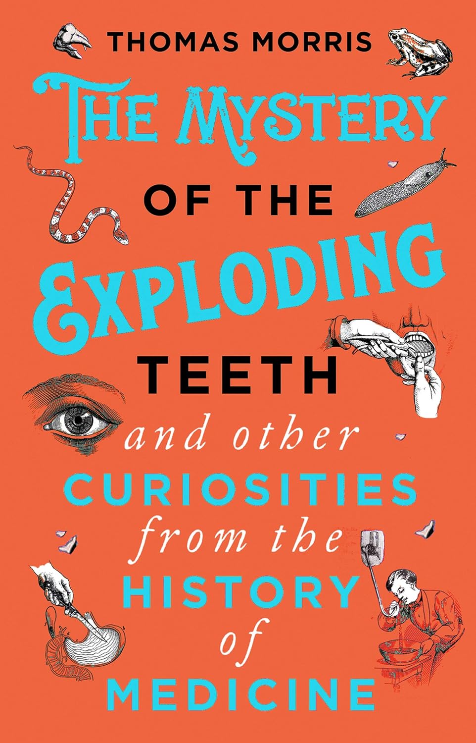 exploding teeth paperback The Mystery of the Exploding Teeth cover