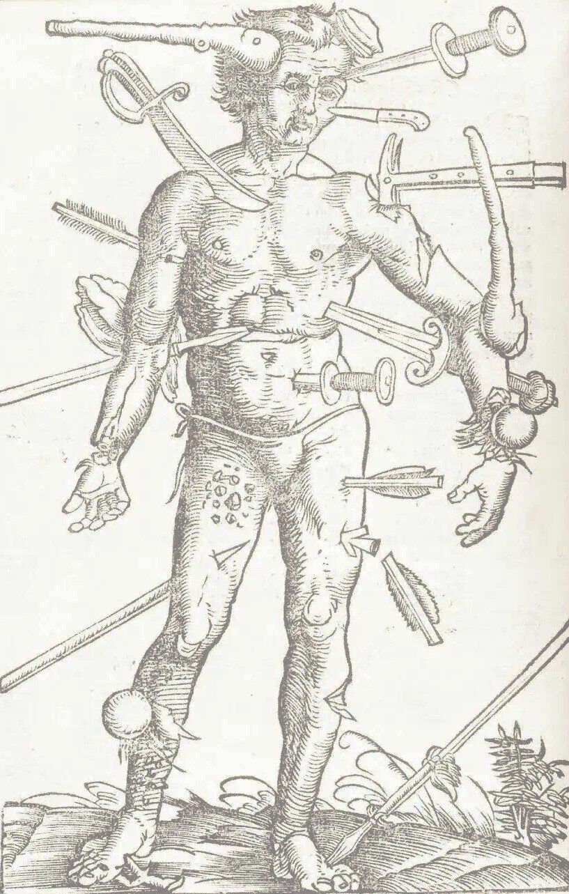 The Wound Man, a medieval medical illustration